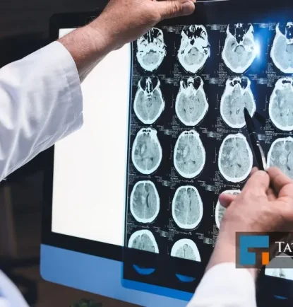 Post Concussion Syndrome Statistics in North Carolina 2025