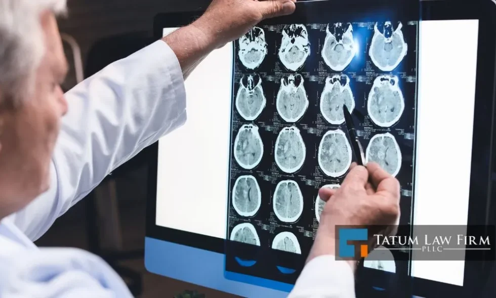 Post Concussion Syndrome Statistics in North Carolina 2025