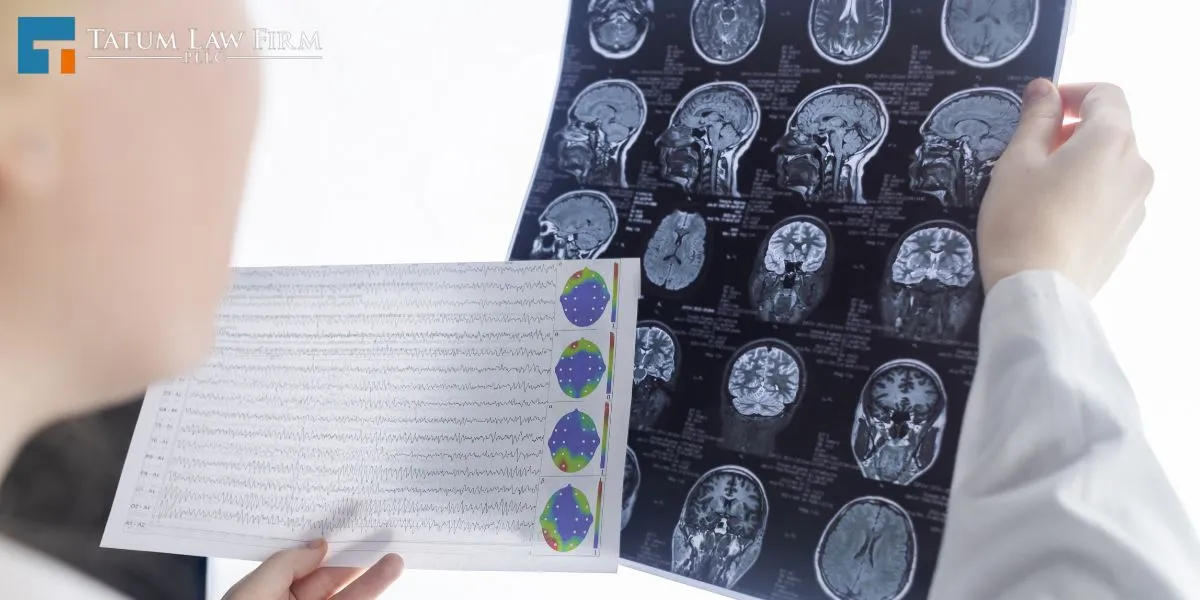 Charleston Traumatic Brain Injury Lawyer